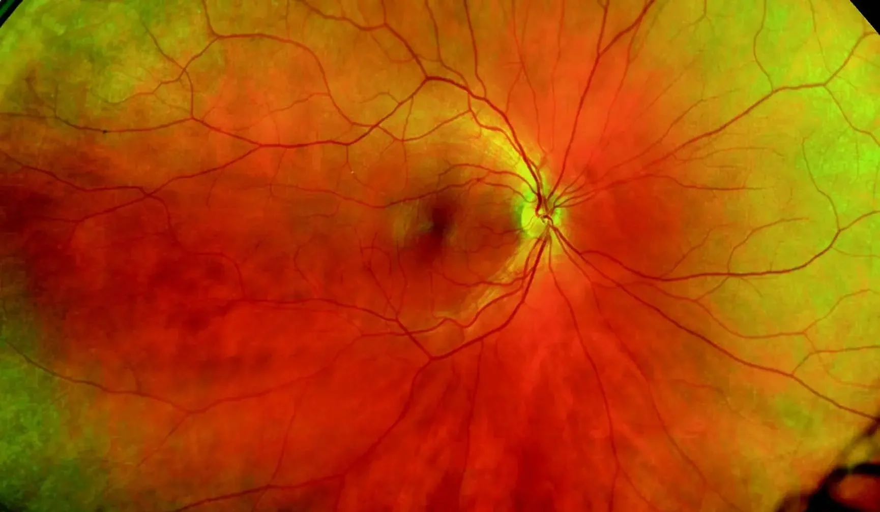 Comprehensive Eye Exams